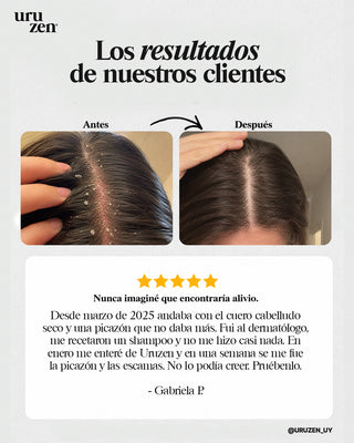 Tónico capilar contra la caspa y dermatitis seborreica