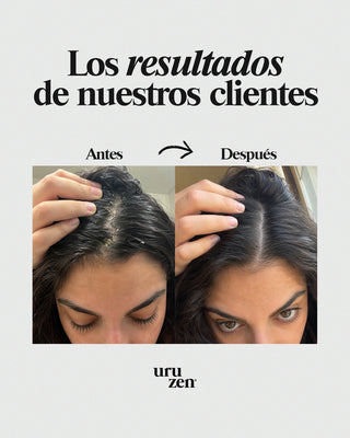 Tónico capilar contra la caspa y dermatitis seborreica